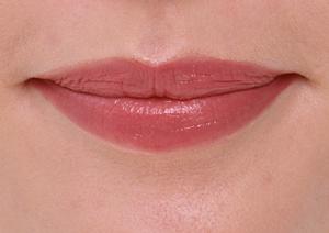 脂肪吸引が受けられる大阪のクリニック